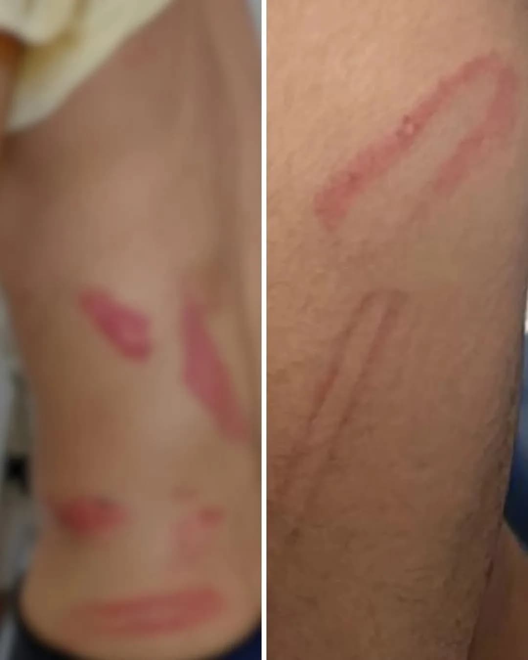 Dupla é presa após sequestrar, espancar e filmar agressões contra mulher trans em Goiás